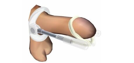 Ormonda yalangoch qizlar fotosurati